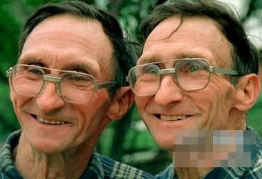 世界上长的最像的一对双胞胎